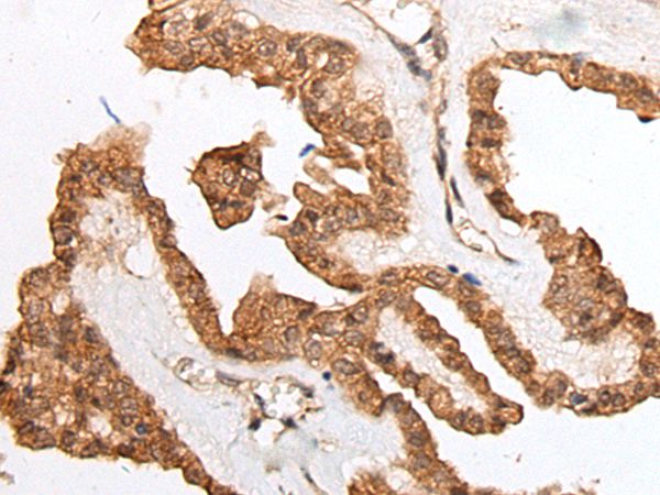 HOXB9 Antibody