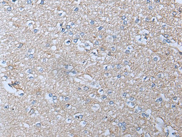 ACKR3 Antibody