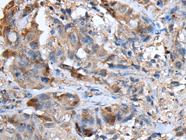 CXCL5 Antibody