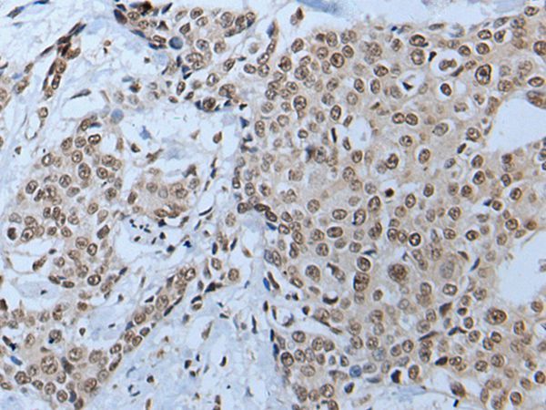 HOXD10 Antibody