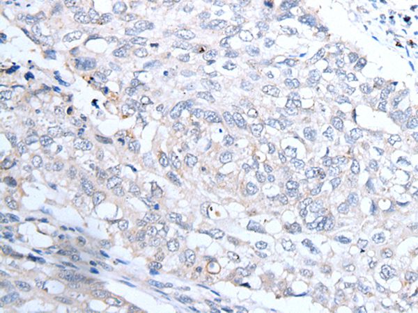 INSR Antibody