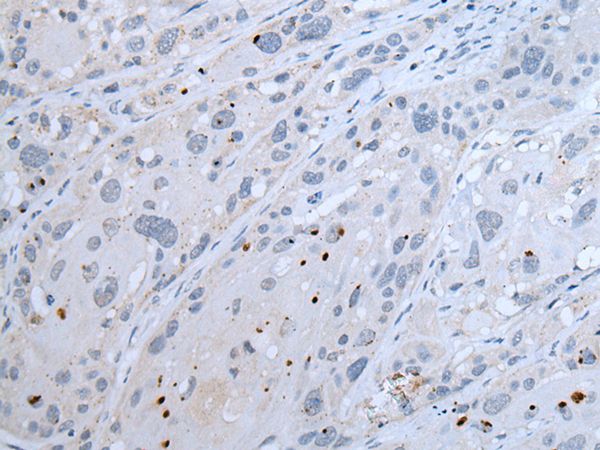 INSR Antibody