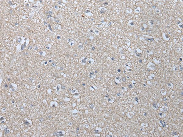 MAGEB1  Antibody