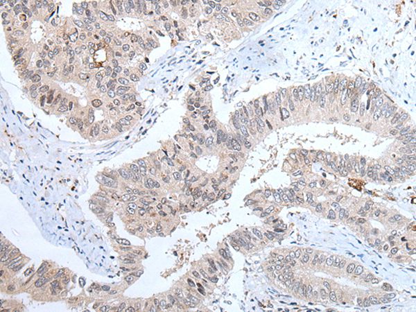 ABHD6 Antibody