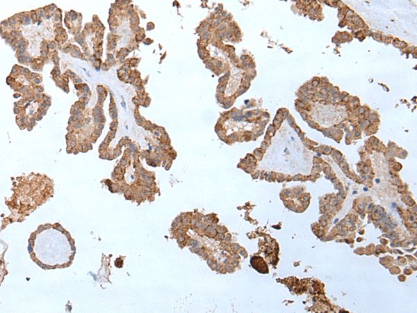 ABHD6 Antibody