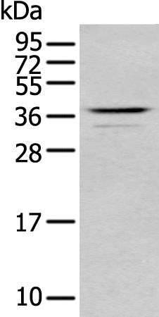 ABHD6 Antibody