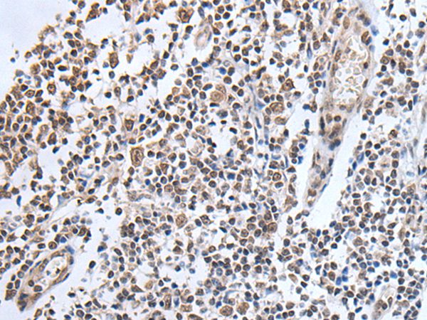ADAMTS7 Antibody