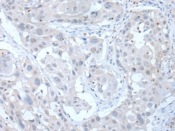 ANGPTL6 Antibody