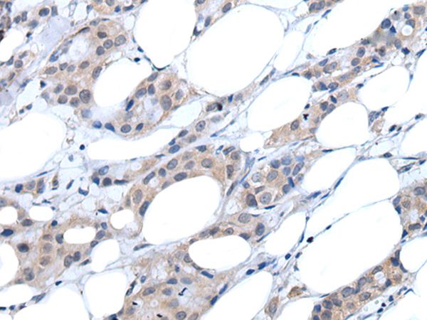 ANGPTL6 Antibody
