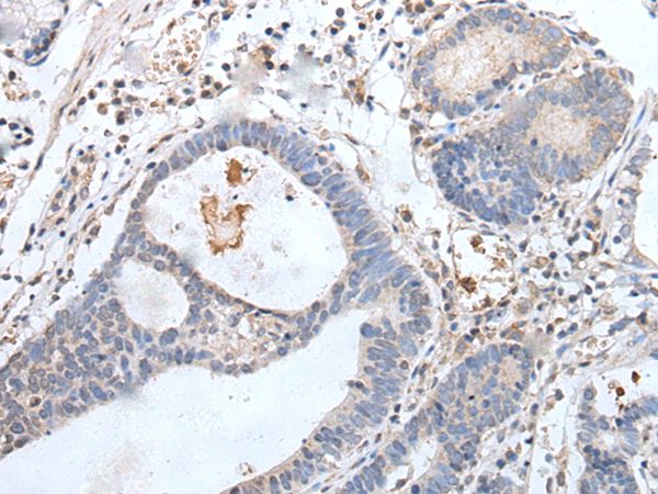 GPD2 Antibody