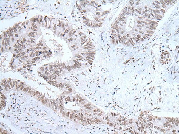 HCRT Antibody