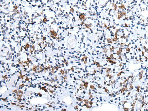 HCRT Antibody