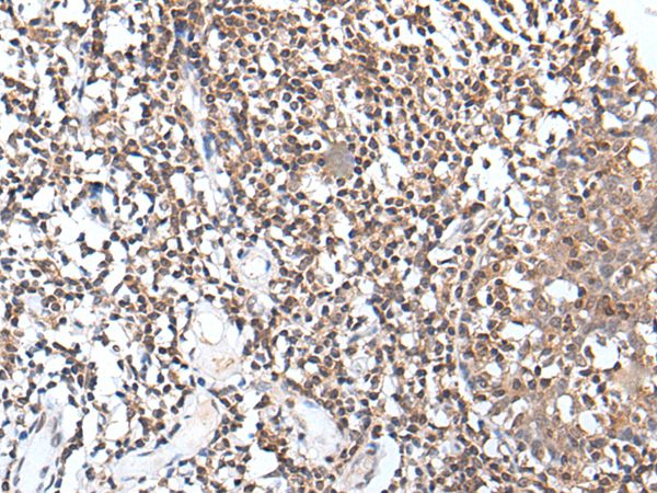 TCF7L1 Antibody