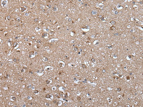 EPHA5 Antibody