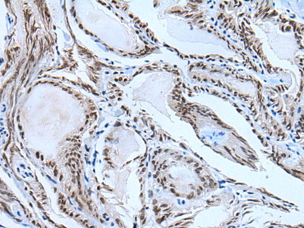 HAND1  Antibody