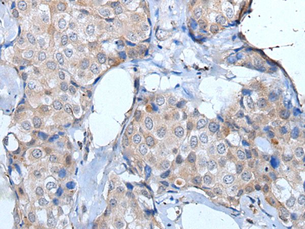 ULK1 Antibody