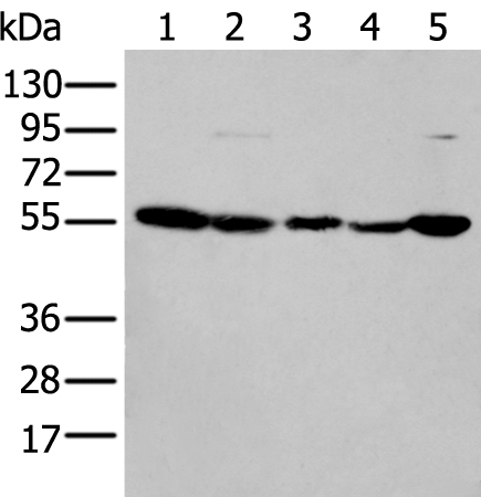 PFKFB3 Antibody