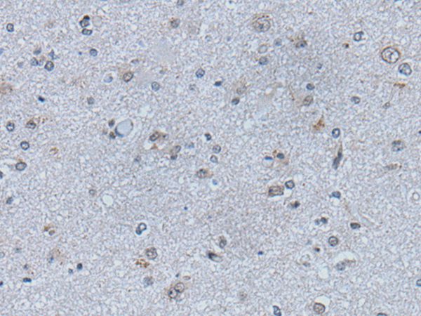 EFNB1 Antibody