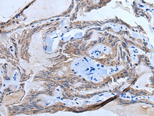 ETFB Antibody