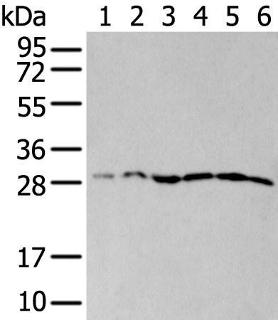 ETFB Antibody