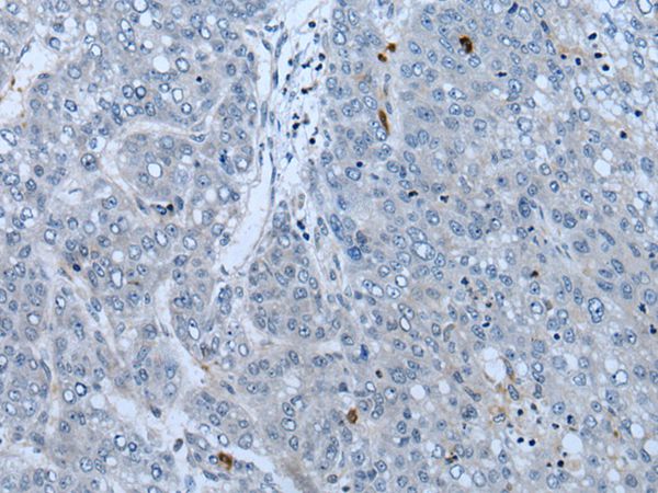 NF1  Antibody