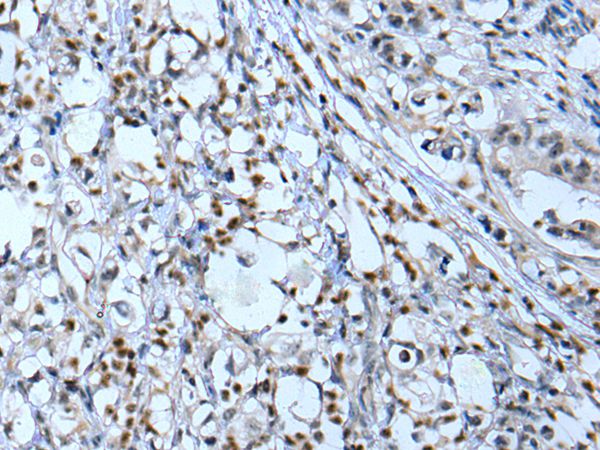 NF1  Antibody