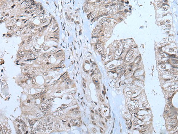 MTHFR  Antibody