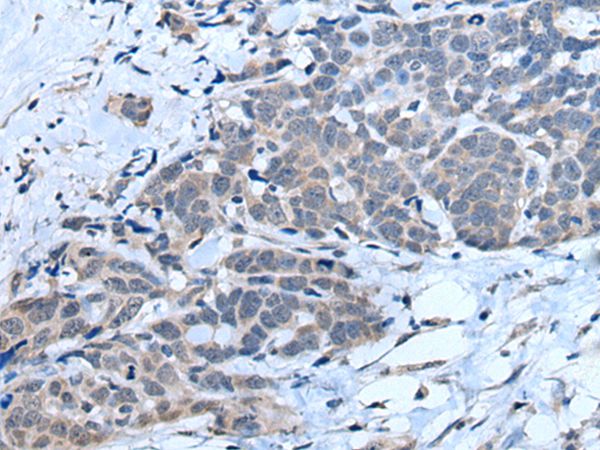 MTHFR  Antibody