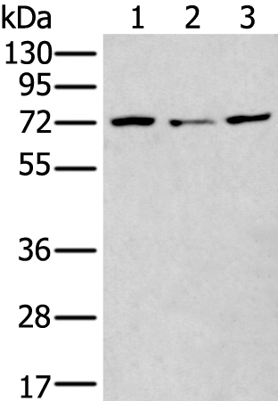 MTHFR  Antibody