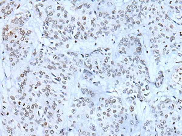 ZBTB11 Antibody