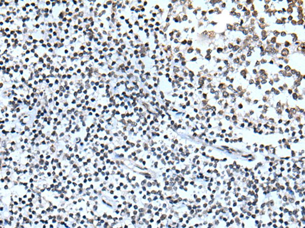 ZBTB11 Antibody