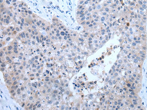 ZDHHC5  Antibody