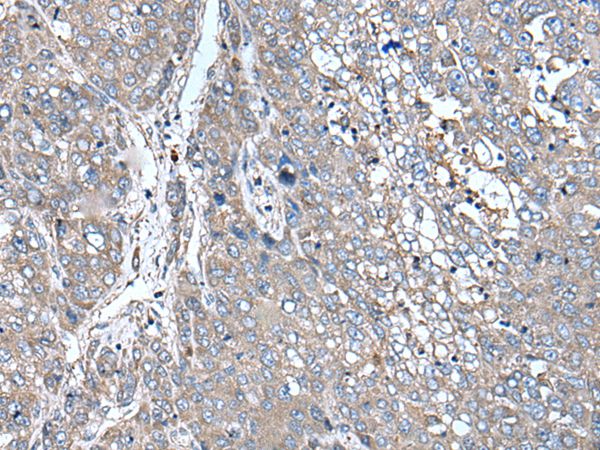 ZIC1 Antibody