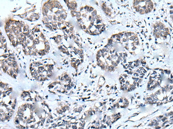 ZIC1 Antibody