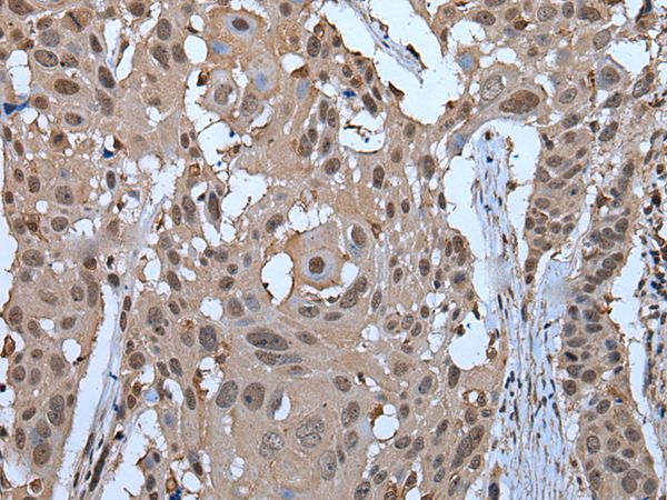 ZNF787 Antibody