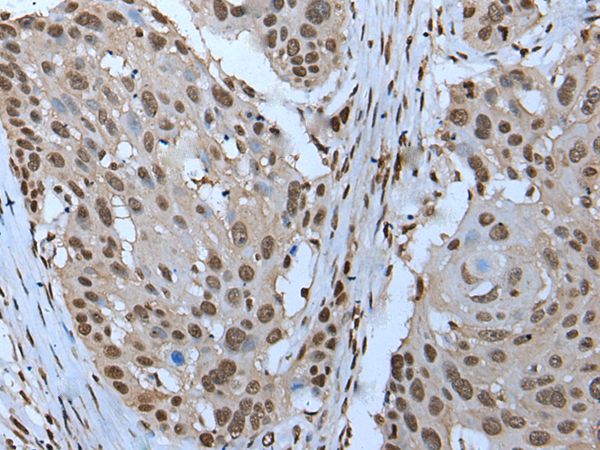 ZNHIT3 Antibody