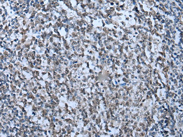 ZNHIT3 Antibody