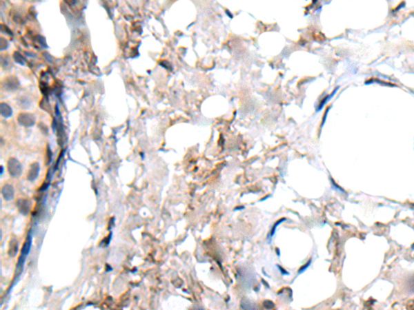 WRN Antibody