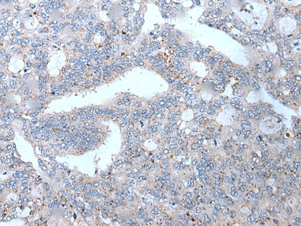 WFDC12 Antibody
