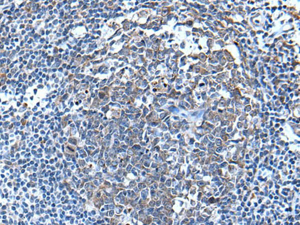 WFDC12 Antibody