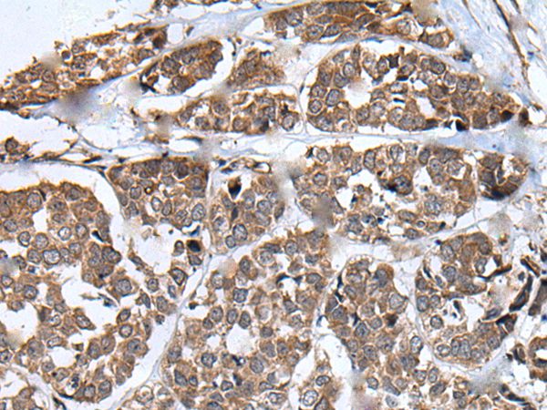 WHSC1 Antibody