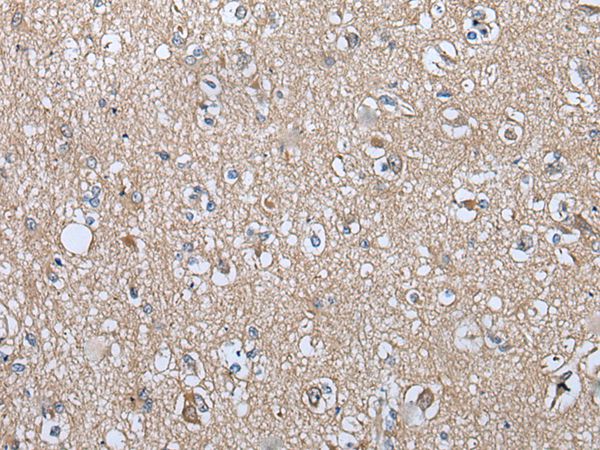 WIPI2 Antibody