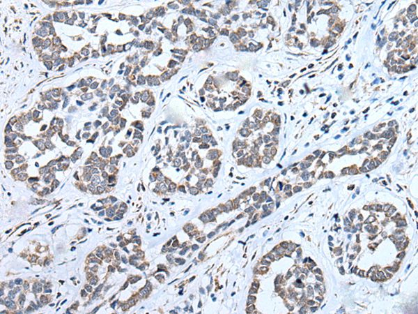 ENKUR Antibody