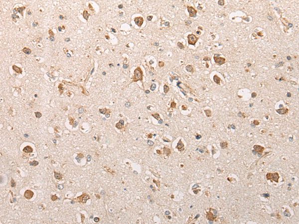 SFR1 Antibody