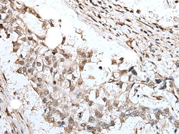 ZNF496 Antibody