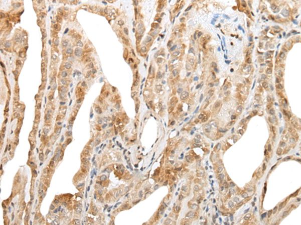ZNF8 Antibody