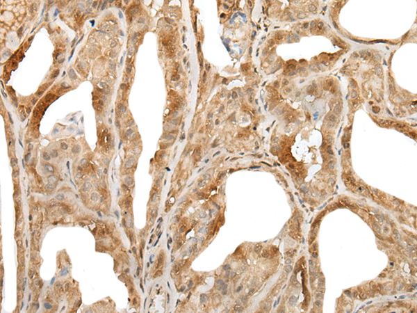 ZUFSP Antibody