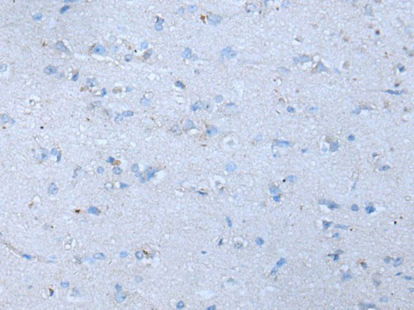 SLC38A1 Antibody