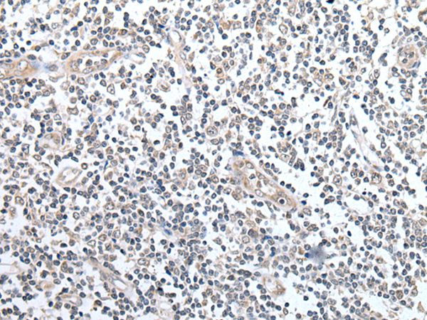 CCL14 Antibody