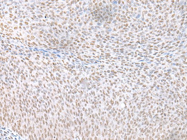 ECT2 Antibody